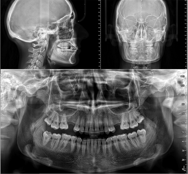 3D томограф NewTom Giano HR Prime (10x8) - Фото 7