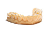 Полимерная смола Dental Peach 1кг - Фото 3